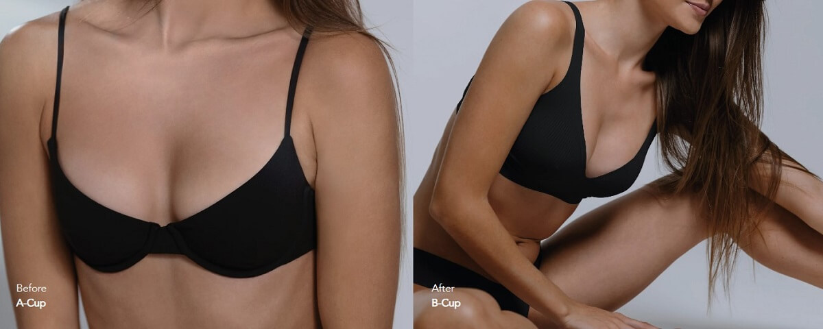 Aesthetic Breast Augmentation Abu Dhabi