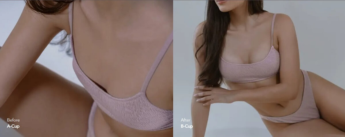 Aesthetic Breast Augmentation Aesthetic Breast Augmentation
