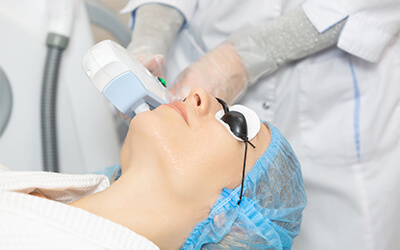 Laser Skin Resurfacing