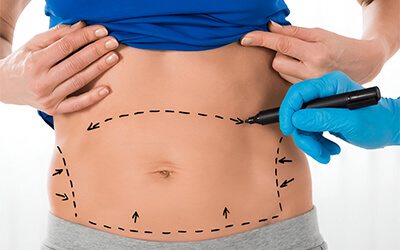 Body Surgery Abu Dhabi